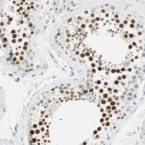 Immunohistochemical staining of human te