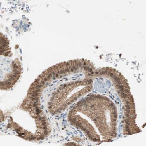 Immunohistochemical staining of human ga