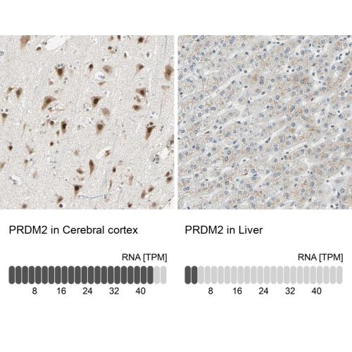 Immunohistochemistry analysis in human c