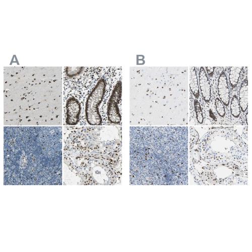 Immunohistochemical staining of human ce