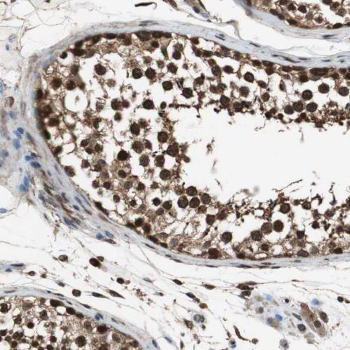 Immunohistochemical staining of human te