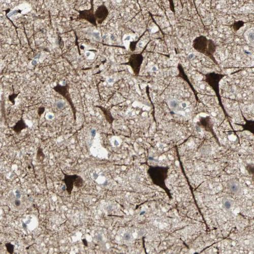Immunohistochemical staining of human ce