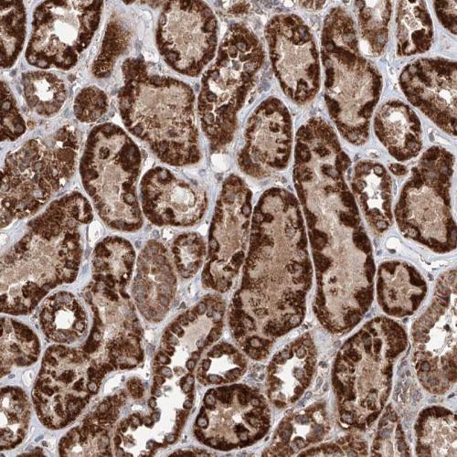 Immunohistochemical staining of human ki