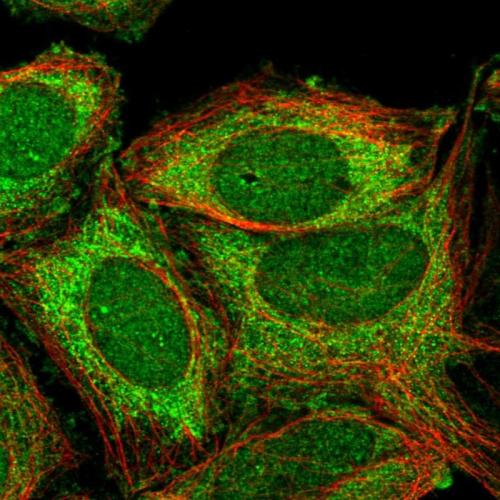 Immunofluorescent staining of human cell