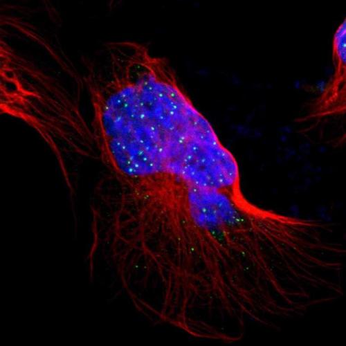 Immunofluorescent staining of human cell