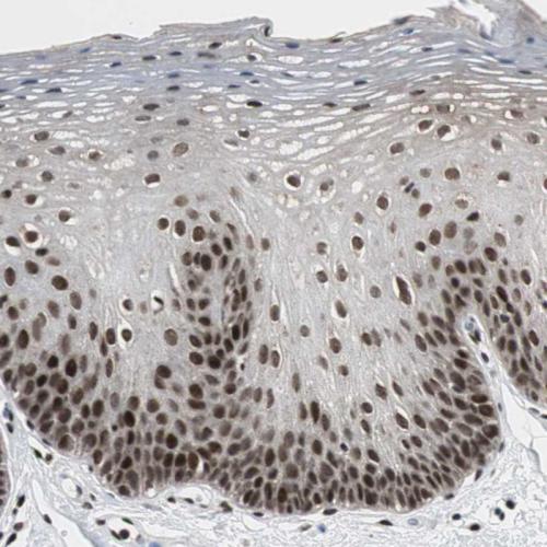 Immunohistochemical staining of human or