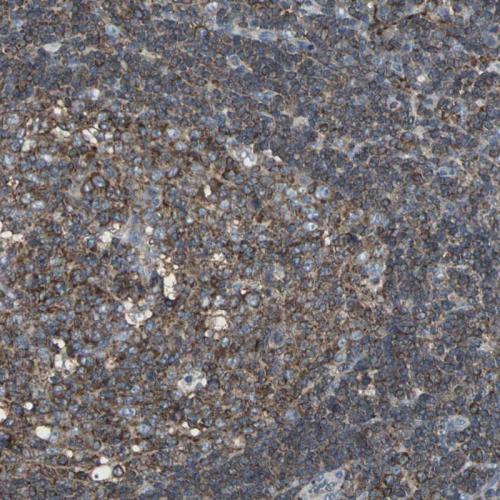 Immunohistochemical staining of human ly