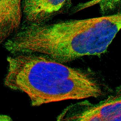 Immunofluorescent staining of human cell