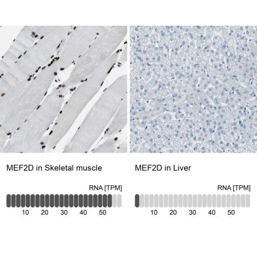 Immunohistochemistry analysis in human s