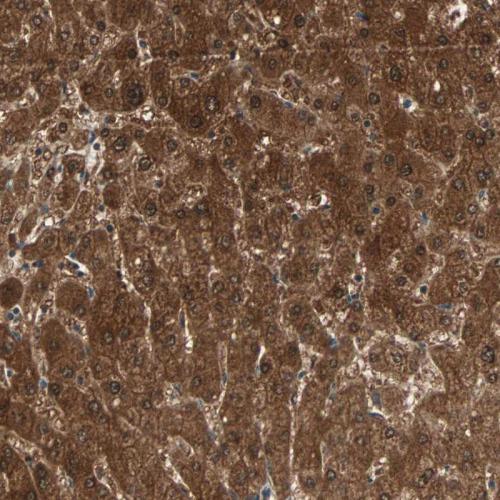 Immunohistochemical staining of human li