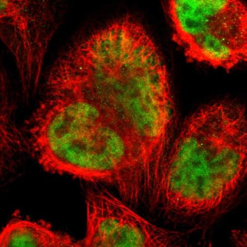 Immunofluorescent staining of human cell