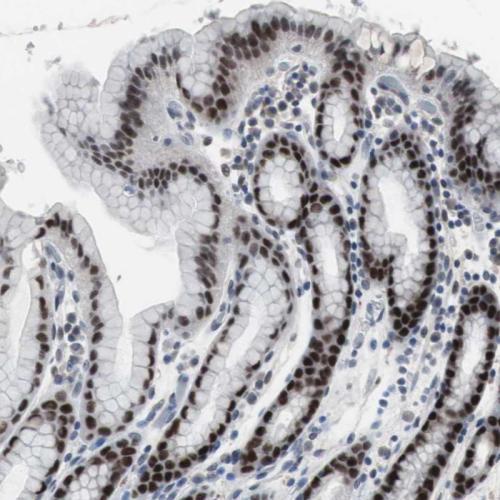 Immunohistochemical staining of human st