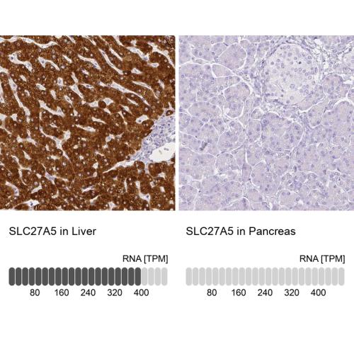 Immunohistochemistry analysis in human l