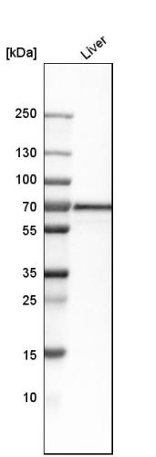 Western blot analysis in human liver tis