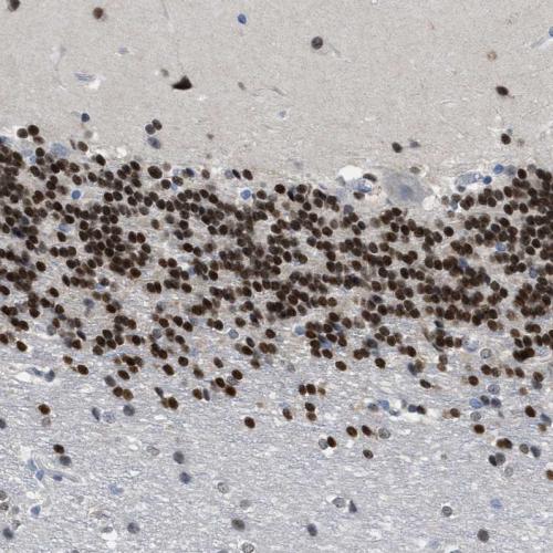 Immunohistochemical staining of human ce