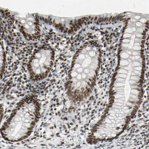 Immunohistochemical staining of human ap