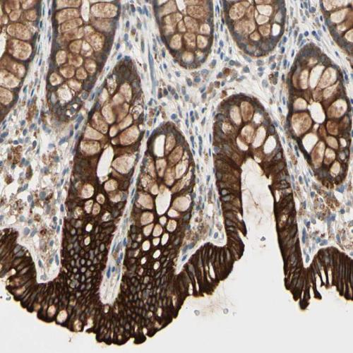 Immunohistochemical staining of human co