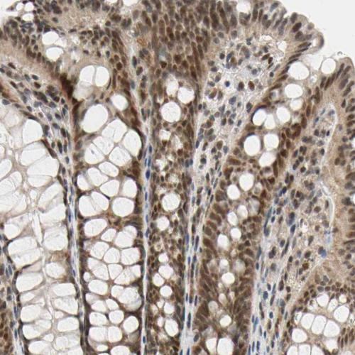 Immunohistochemical staining of human co