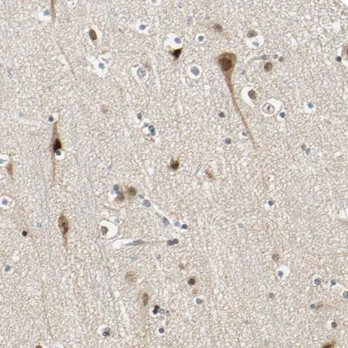 Immunohistochemical staining of human ce