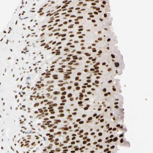 Immunohistochemical staining of human ur