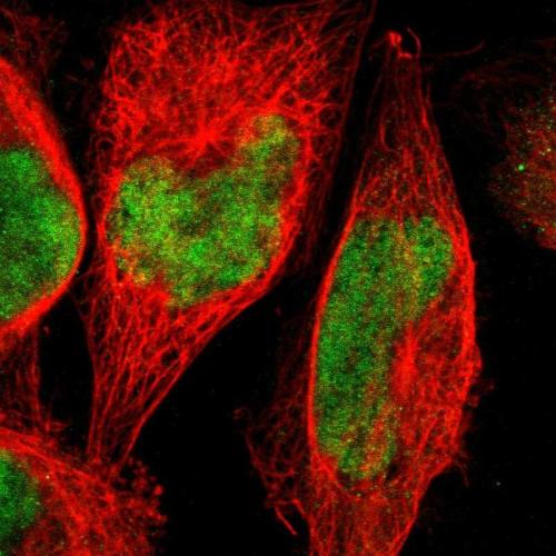 Immunofluorescent staining of human cell