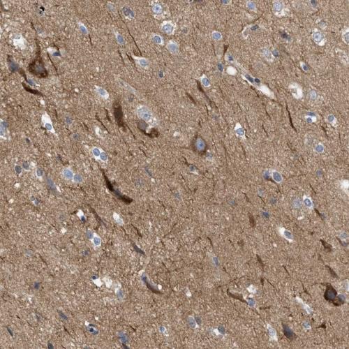 Immunohistochemical staining of human ce