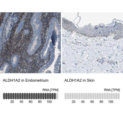 Immunohistochemistry analysis in human e