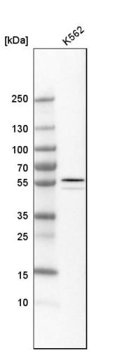 Western blot analysis in human cell line