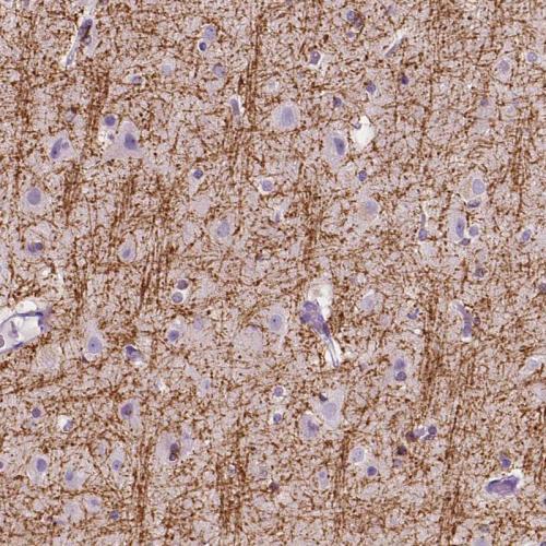 Immunohistochemical staining of human ce