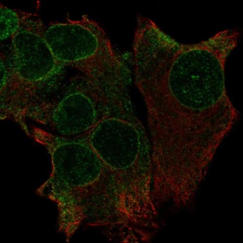 Immunofluorescent staining of human cell