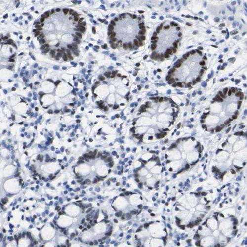 Immunohistochemical staining of human sm
