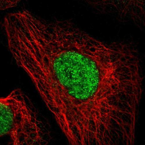 Immunofluorescent staining of human cell