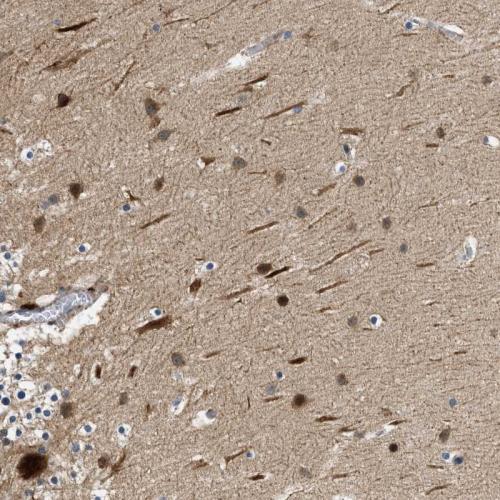 Immunohistochemical staining of human ce