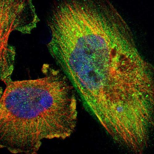 Immunofluorescent staining of human cell