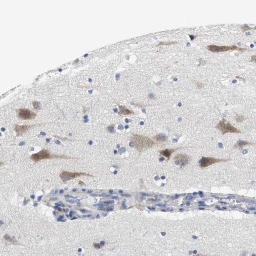 Immunohistochemical staining of human ce