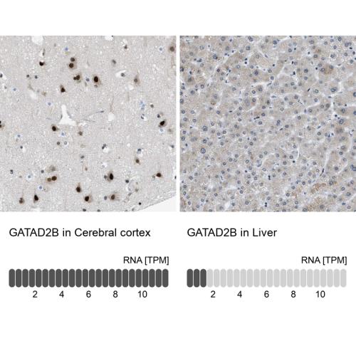 Immunohistochemistry analysis in human c