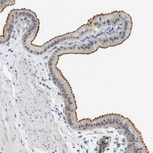 Immunohistochemical staining of human ga