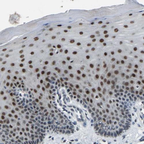 Immunohistochemical staining of human ce