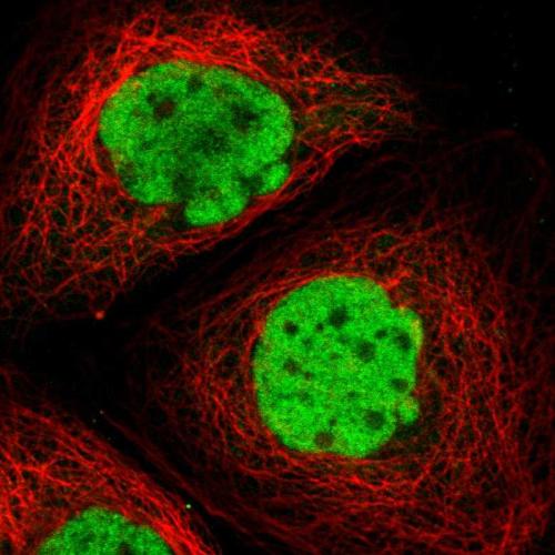 Immunofluorescent staining of human cell