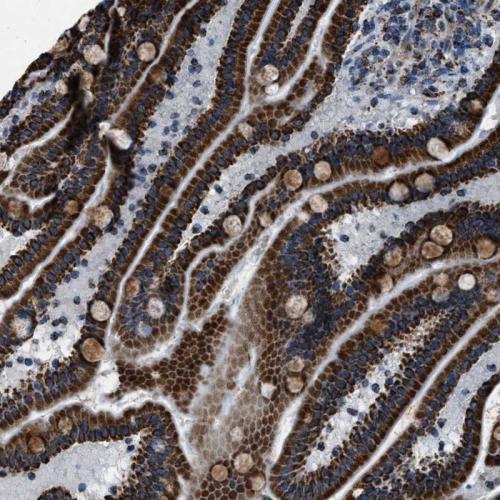 Immunohistochemical staining of human du
