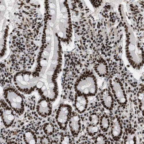 Immunohistochemical staining of human du