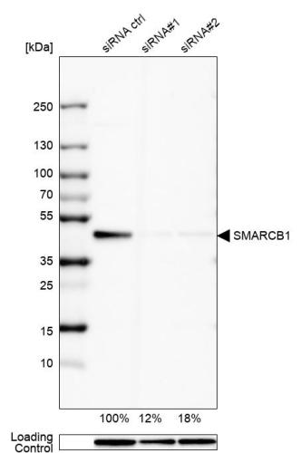 Western blot analysis in HEK293 cells tr