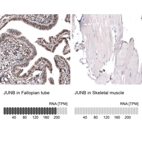 Immunohistochemistry analysis in human f