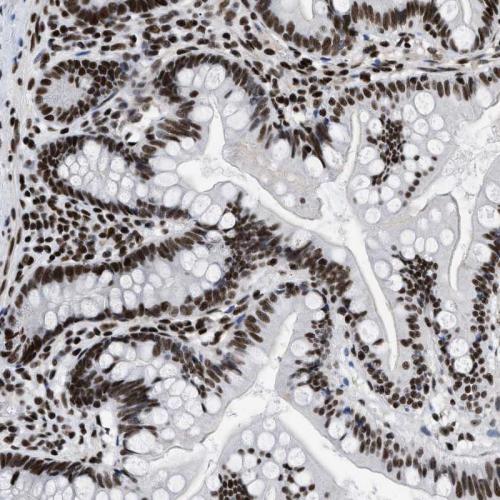 Immunohistochemical staining of human sm