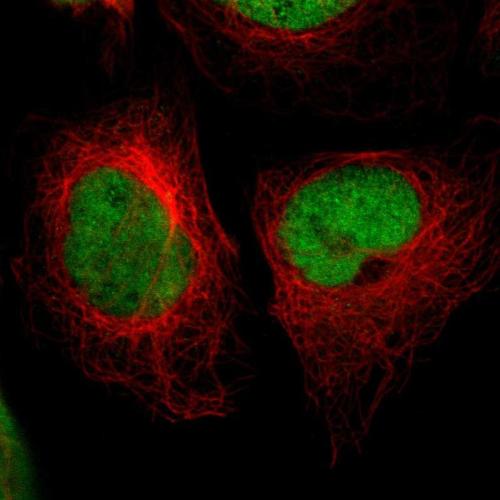 Immunofluorescent staining of human cell