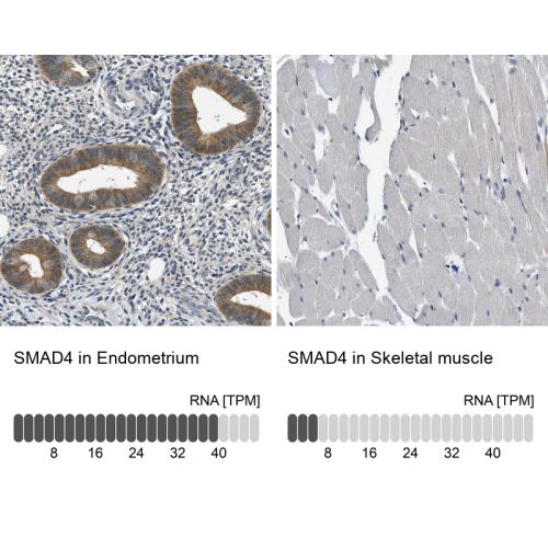 Immunohistochemistry analysis in human e