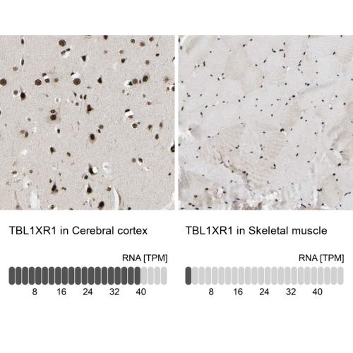 Immunohistochemistry analysis in human c