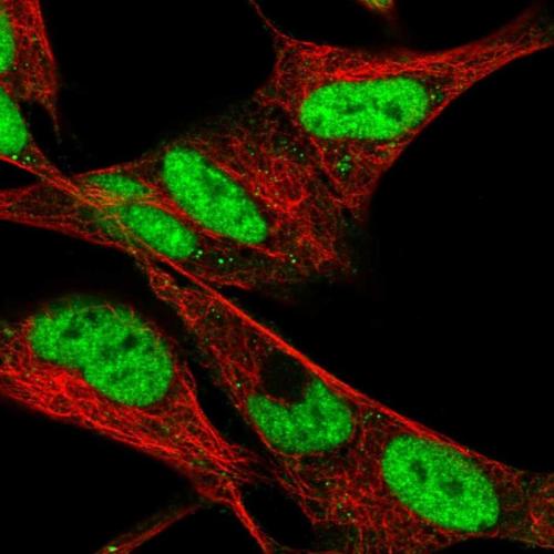 Immunofluorescent staining of human cell
