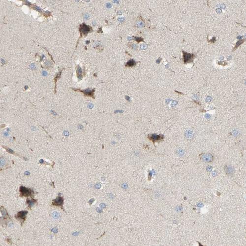 Immunohistochemical staining of human ce