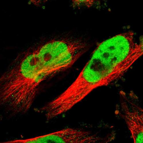Immunofluorescent staining of human cell